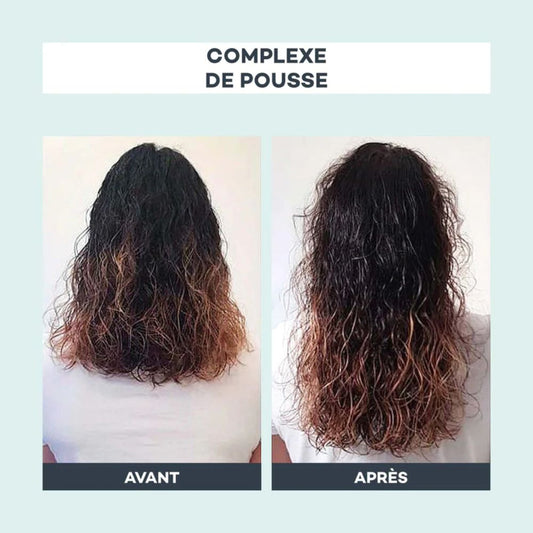 Complexe de Pousse: Hair Growth Complex - D-Lab