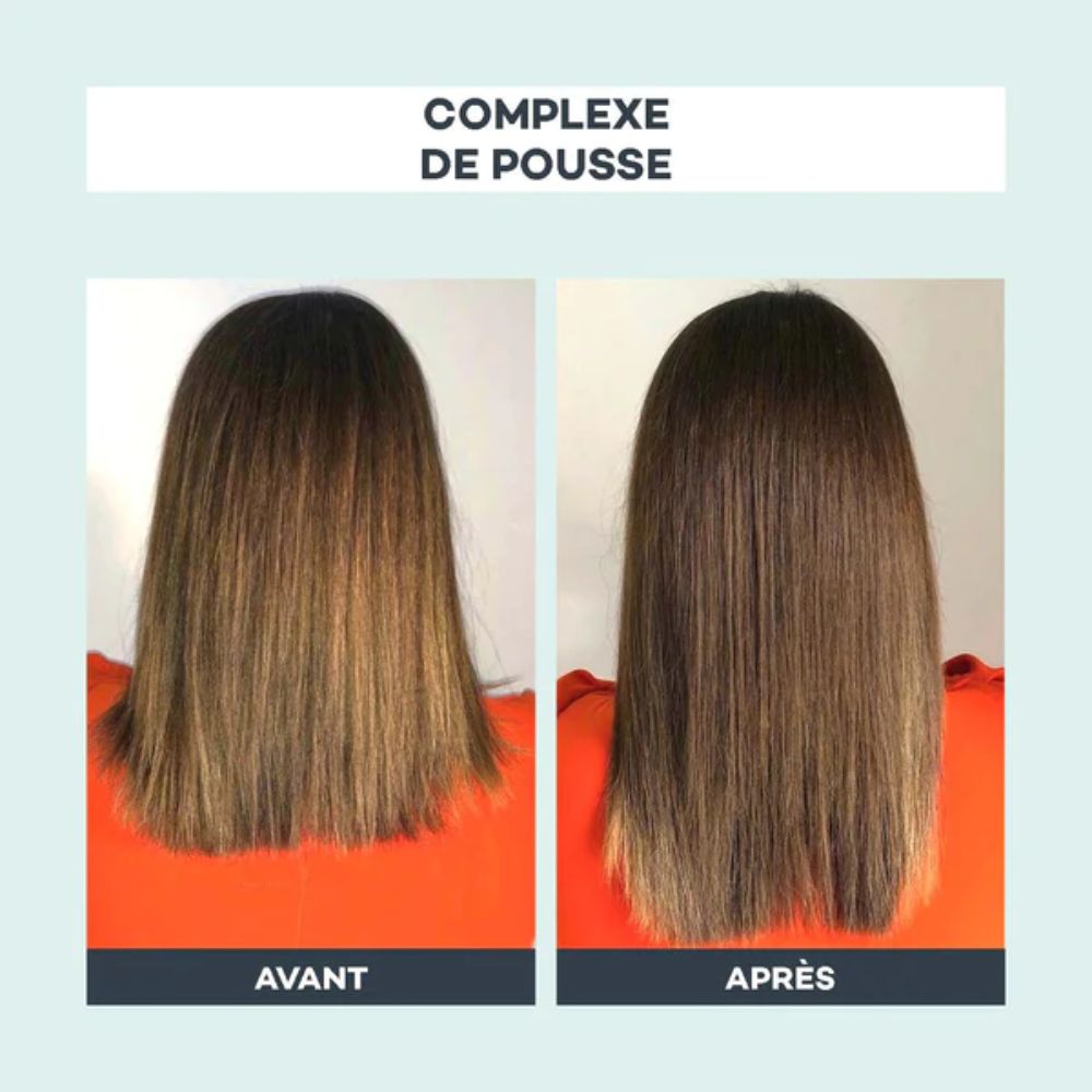 Complexe de Pousse: Hair Growth Complex - D-Lab